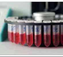 Дешифрирането на резултатите от изследване на кръвта при децата