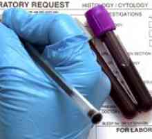 Rw кръвен тест
