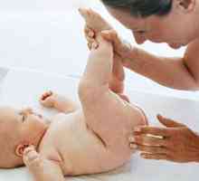 Пилинг на кожата при новородени