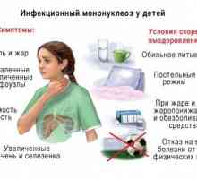 Симптомите на инфекциозна мононуклеоза в детето и лечението му