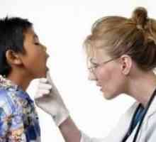 Симптомите на мононуклеоза при децата