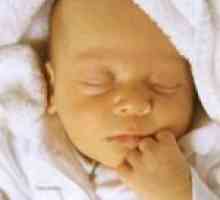 Симптомите на жълтеница при новородени бебета