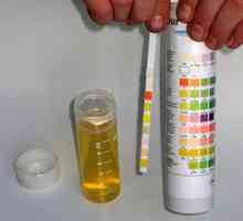 Колко време е необходимо, за анализ на урина?