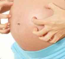 Обрив на стомаха по време на бременност