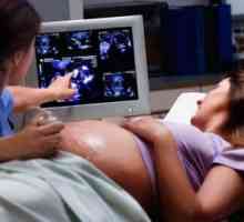 Третият ултразвук по време на бременност