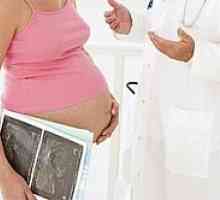 Тромбофилия и бременност