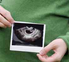 Узи по време на бременност: график