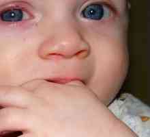 Каква е причината за червени очи при новородени?