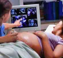 Значението на използването на ултразвук по време на бременност