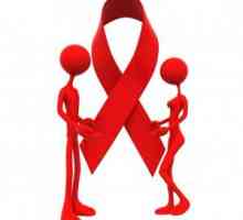 ХИВ и СПИН - симптоми и лечение