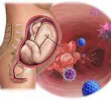 Вътрематочната инфекция по време на бременност и новороденото
