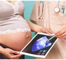 Падежът на плацентата по време на бременност