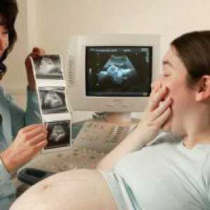 Бременност 37 седмици: седалищно предлежание представяне