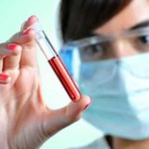 Биохимичен анализ на кръв за желязо
