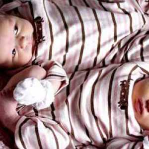 Близнаците са различни от двуяйчните