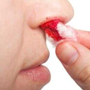 Какво да правите, когато носът е кървенето?