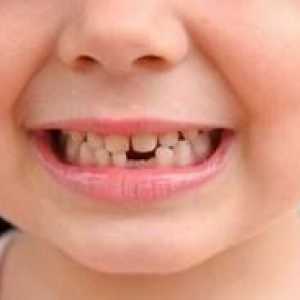 Какво трябва да знаете за първични зъби при децата?