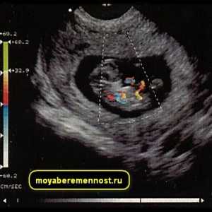 Ултразвуков доплер по време на бременност