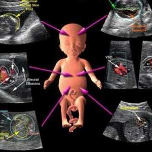Ултразвуков доплер по време на бременност