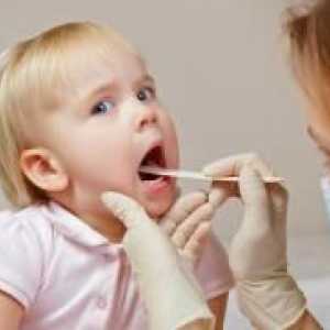 Тонзилит при деца - Лечение