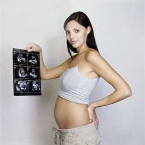 Снимки ултразвук 20 седмици бременни