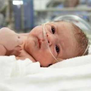 Хипоксия при новородени: причини, симптоми и лечение