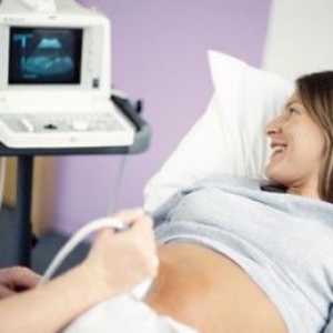 Колко често може да направи ултразвук по време на бременност