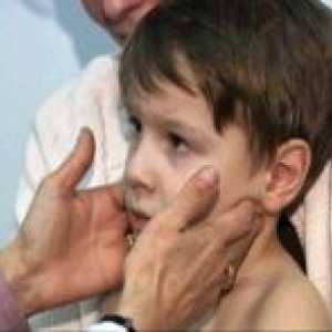 Как мога да се лекува от мононуклеоза в детето