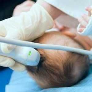 Мозъчна киста при новородени