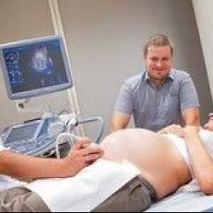 Когато се налага да се направи рутинна ултразвук по време на бременност?