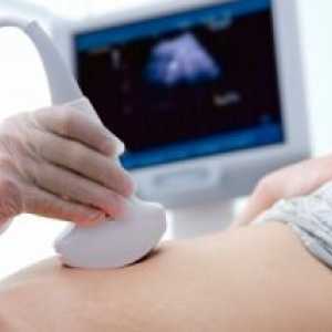 Когато се налага да се направи ултразвук по време на бременност: експертни препоръки
