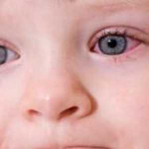 Червени очи от едно дете