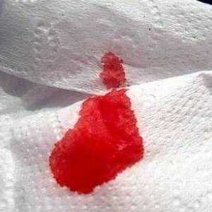 Кръв от ануса по време на бременността