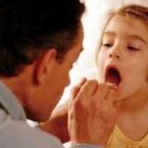 Лечение на фарингит при деца