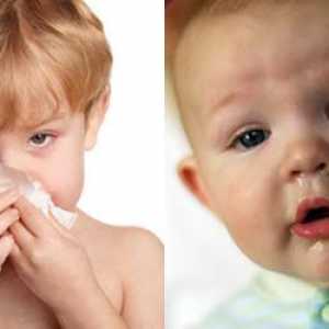 Лечение на обикновената настинка при децата
