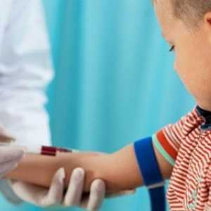 Лимфоцитите и тяхната роля в нивата на кръвната на детето са нормални, ниски и високи стойности