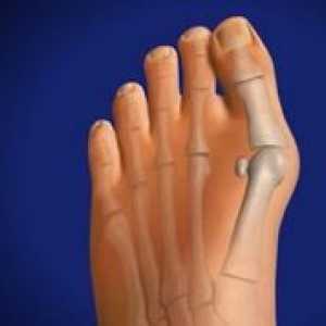 Методи за лечение и отстраняване на костите на крака