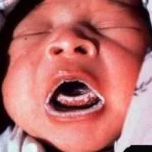 Млечница в устата на бебето