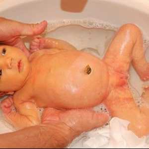 Жилки на кожата при новородени