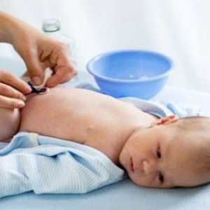 Обработка пъпа при новородени и предизвиква кървене