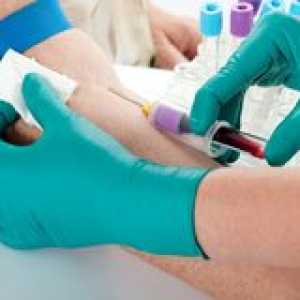 Общи и биохимични изследвания на кръвта при възрастни