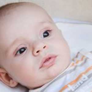 Особености и заболяване на новороденото кожата