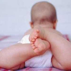 Пелена дерматит при деца - произтича от кожата триене срещу мръсни памперси