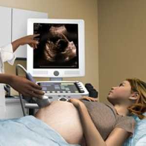 Първо ултразвук прожекцията на по време на бременност