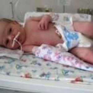 Пневмония при новородени