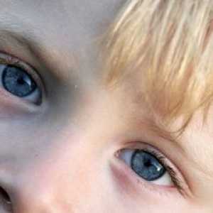 Защо боли очите на едно дете