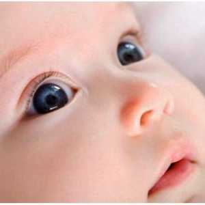 Защо тлеят очите на новородено дете?