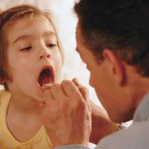 Правилното лечение на гърлото при деца на възраст от 2 до 5 години
