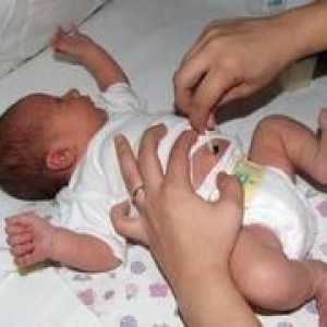 Правилната грижа на пъпната връв на новородени