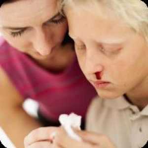 Причини за възникване на кръвотечение от носа при децата